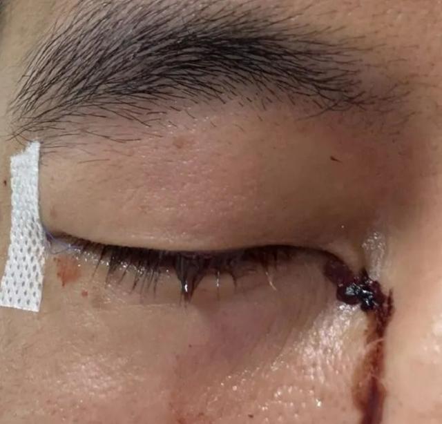 澳客注册-比赛期间突发意外,球员受伤情况引关注的简单介绍